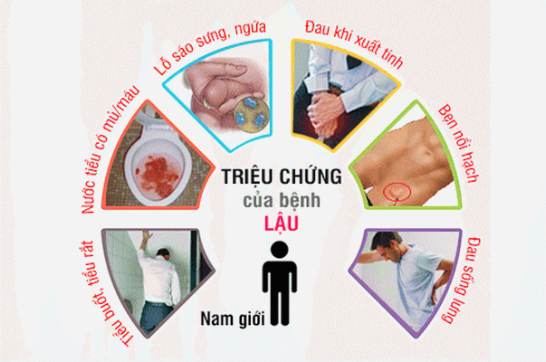 Hệ lụy nguy hiểm của bệnh lậu