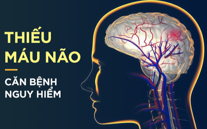 Rối loạn tiền đình nặng tưởng vô phương cứu chữa: Hàng ngàn người bất ngờ đón tin vui!