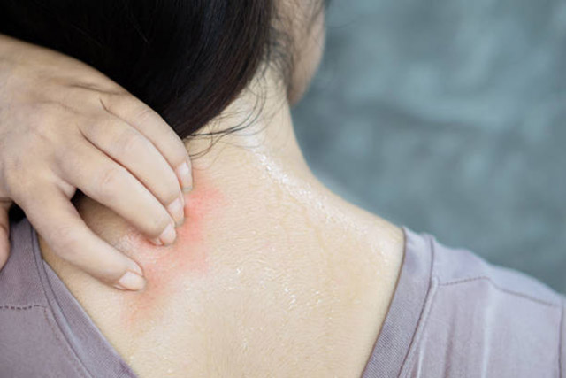Đổ mồ hôi ở 6 bộ phận này đừng chủ quan, có thể là dấu hiệu của đột quỵ vào ngày nóng