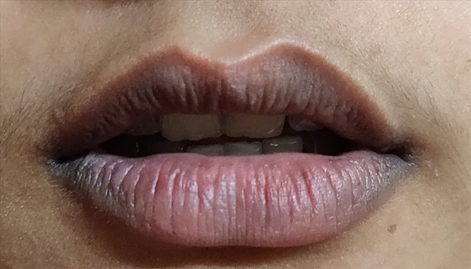 Ba vị trí cơ thể thâm đen báo hiệu thận yếu