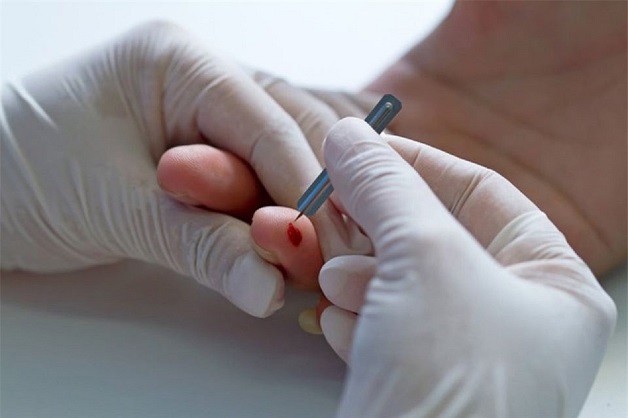 Có nên chích đầu ngón tay khi đột quỵ?