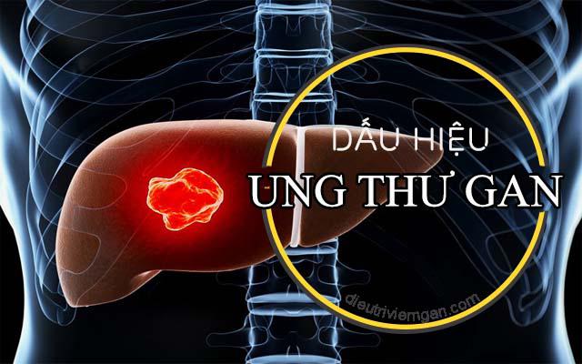 8 thay đổi nhỏ nhưng là dấu hiệu cảnh báo ung thư gan, kiểm tra ngay nếu có cần được khám sớm