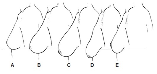 6 việc giúp ngực không chảy sệ sau sinh