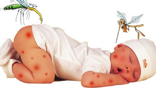 Nhận biết các dấu hiệu viêm não Nhật Bản ở trẻ