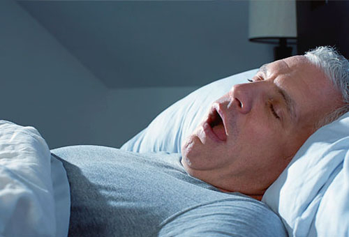 Hội chứng ngưng thở khi ngủ