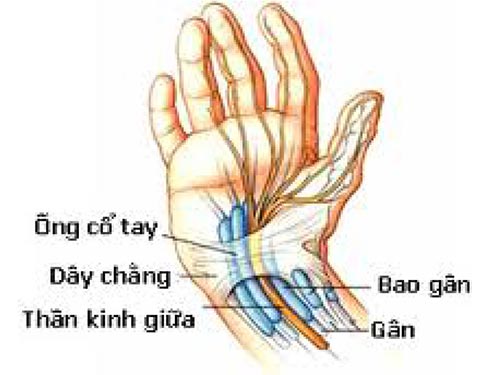 Hội chứng ống cổ tay khi mang thai