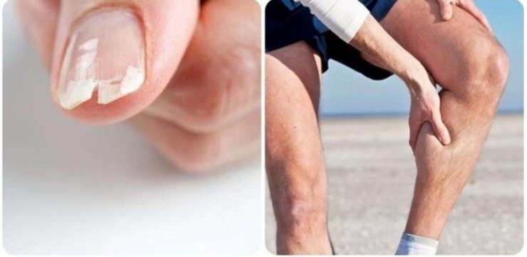 Dấu hiệu cảnh báo cơ thể đang thiếu canxi hay bị nhiều người bỏ qua